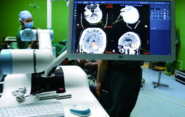 大脑手术也能开“GPS”定位，神经外科手术机器人来啦！